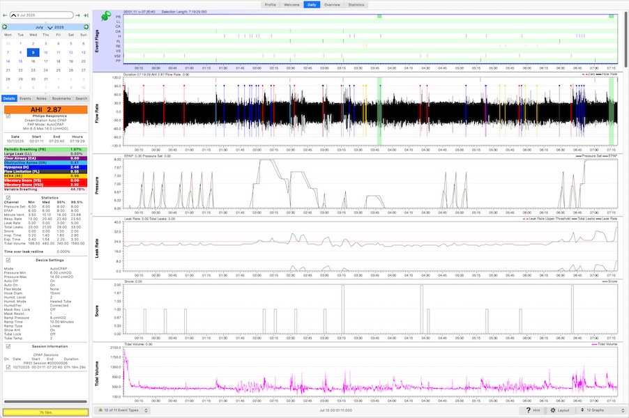 OSCAR CPAP analysis software displaying breath-by-breath flow rate, pressure and event graphs on a computer screen